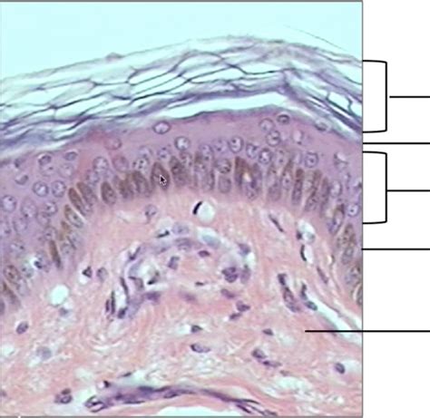 Stratified Squamous Epithelium Keratinized Skin