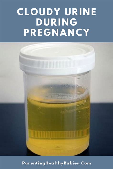 Pregnancy Urine Color Chart Hans Silverman