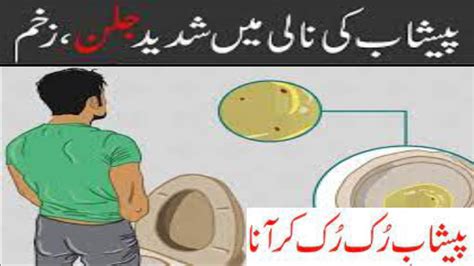 Urinary Tract Infection In Urduhindi Peshab Mein Jalanurine Infection Ka Ilaj Youtube