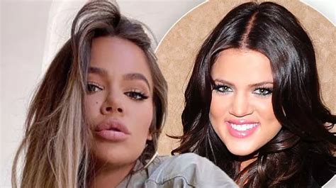 Khloe Kardashian S Plastic Surgery Journey In Full After She Confirmed Nose Job Mirror Online