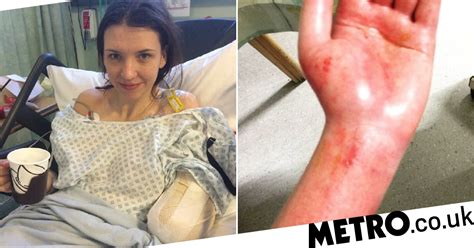 model s arm chopped off after being electrocuted while charging her laptop metro news
