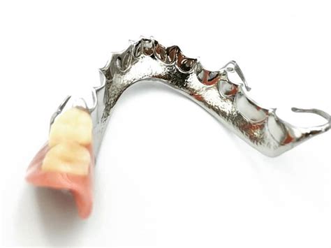 Removable Partial Chrome Metal Dentures Are Another Type Of Partial Denture Which Are Used To