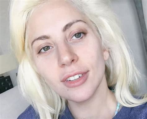 Does Lady Gaga Have Plastic Surgery Before And After 2018