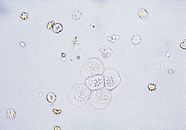 Their presence indicates acute or chronic affection of the kidneys. Examination of the Urinary Sediment | Veterian Key