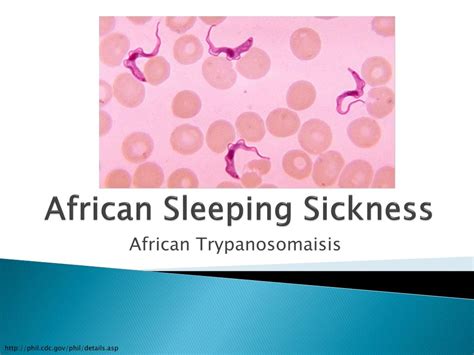 Ppt African Sleeping Sickness Powerpoint Presentation Free Download Id3109395