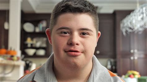 Down Syndrome Answers: What does Down syndrome look like? - YouTube gambar png