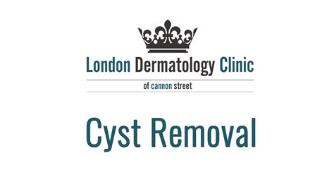Cyst Removal Same Day £299 London Dermatology Clinic