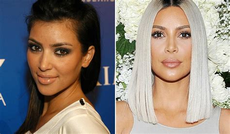 Kim Kardashian Plastic Surgery True Or False Past Vs Present Photos