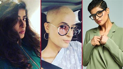 Tahira Kashyap Opens Up About Her Journey Of Dealing With Hair Loss To