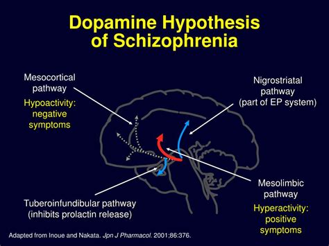 Ppt Schizofrenia Powerpoint Presentation Free Download Id3659510