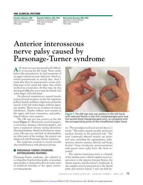 Anterior Interosseous Nerve Syndrome