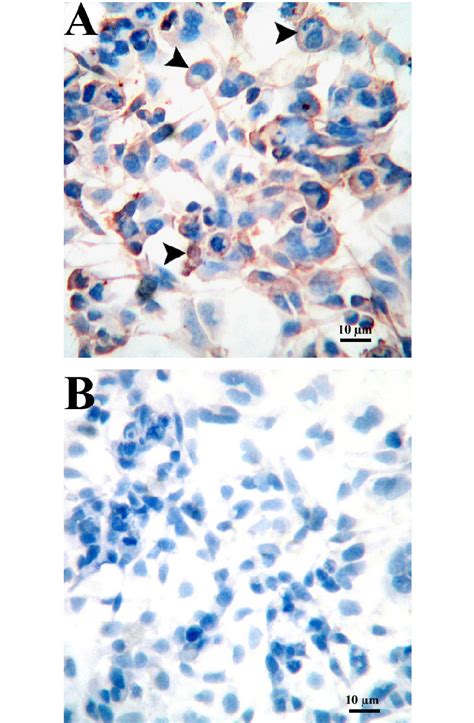 immunolocalization of gal 1 a and gal 3 b in htr8 svneo cells download scientific diagram