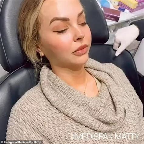 The Bachelorettes Angie Kent Gets A Vampire Facial Before Quarantine