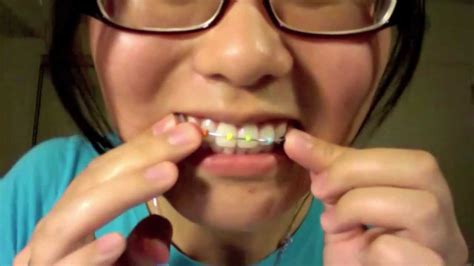 Tutorial How To Make Fake Braces That Look Real Youtube