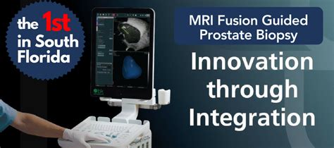 1st Urologist In South Florida BK Fusion MRI Guided Prostate Biopsy