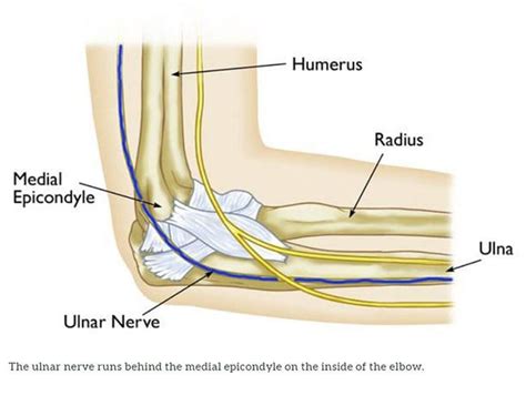 Cubital Tunnel Syndrome Whats That Brandon P Donnelly Md