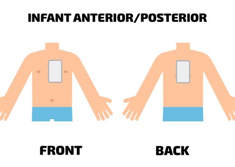 Infant Aed Pads Everything You Need To Know