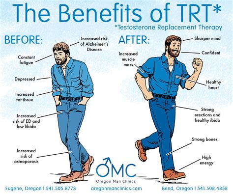 Testosterone Replacement Therapy Los Angeles Trt Clinic 58 Off