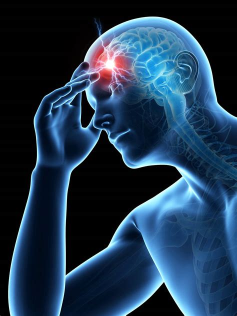 Frontal Headache Relief Mind And Body Chiropractic