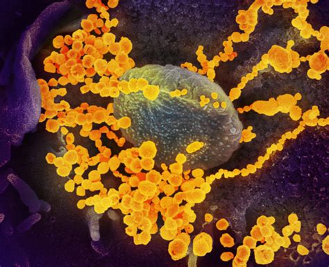 Puede El Virus Sars Cov Integrarse En Nuestro Genoma Cuaderno De
