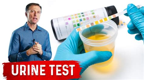 Urine Test Simplified Youtube