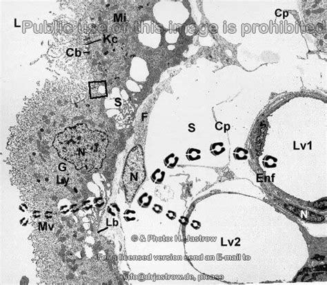 To keep one's shirt on. Blut-Liquor Schranke Übersicht - Dr. Jastrows EM Atlas