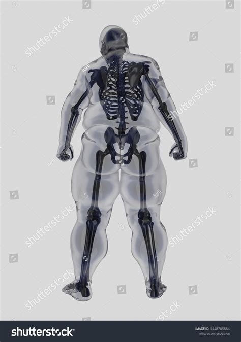 뚱뚱한 남자의 X Ray 스톡 일러스트 1448705864 Shutterstock