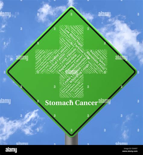 Stomach Cancer Hi Res Stock Photography And Images Alamy