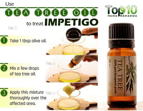 Impetigo Home Remedies Prevention And When To See A Doctor Top 10