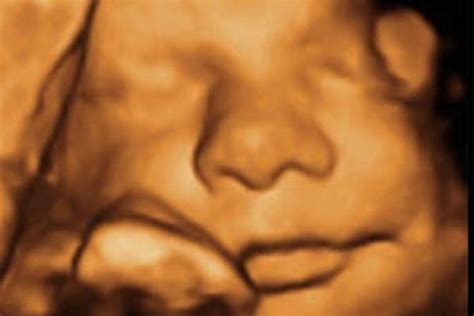 Schwangerschaft Bilder Aus Dem Baby Bauch Urbiade