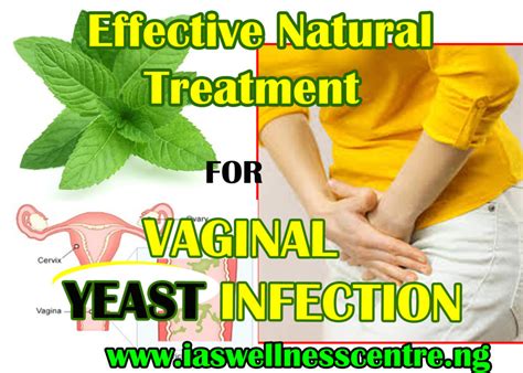 Effective Natural Treatment For Vaginal Yeast Infection In Nigeria I
