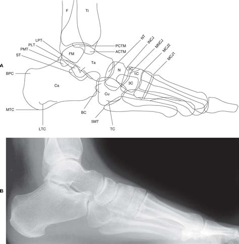 5 The Normal Foot And Ankle Musculoskeletal Key