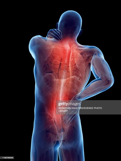 Back Pain Conceptual Illustration High Res Vector Graphic Getty Images