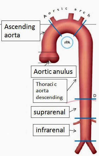 Anatomy Of Aorta
