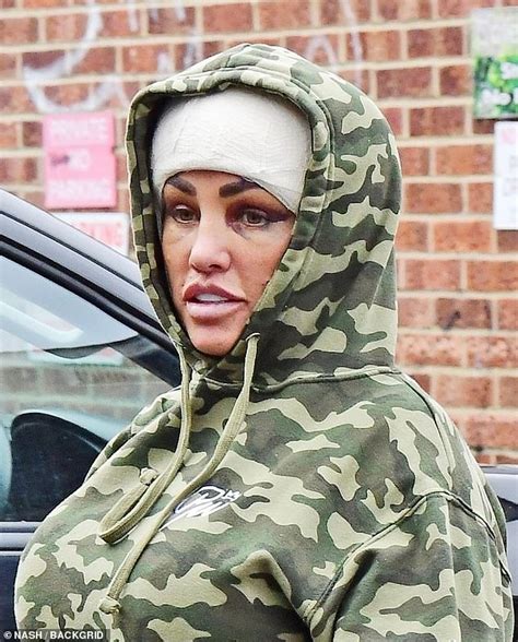 Bandaged And Bruised Katie Price Continues To Show Results Of Her Latest Surgery