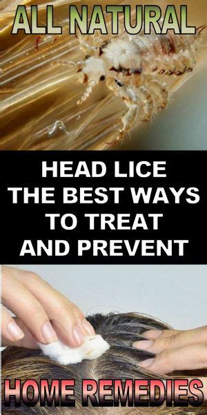 Head Lice funny, Best and also fastest All-natural ...