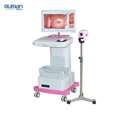 CE ISO Digital Video Colposcope For Gynecology Cervix Vagina Examination China Colposcope And