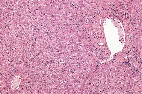 5 Anatomy And Functional Histology Of The Liver Medicine