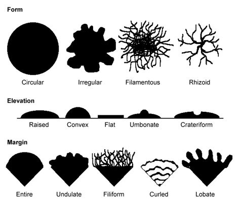 Colony Morphology Of Bacteria How To Describe Bacterial Colonies