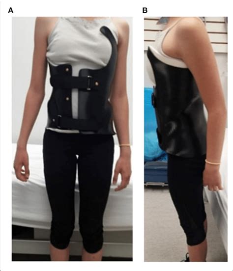 A Participant Wearing A 3d Printed Nylon12 Brace In A Frontal View Download Scientific