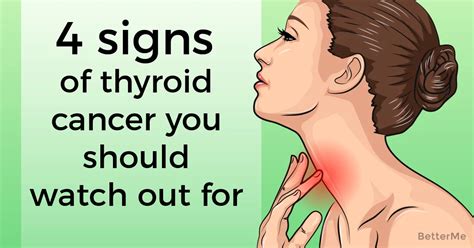 What Are Signs And Symptoms Of Thyroid Cancer Signs And Symptoms Of