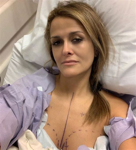 Double Mastectomy Before And After