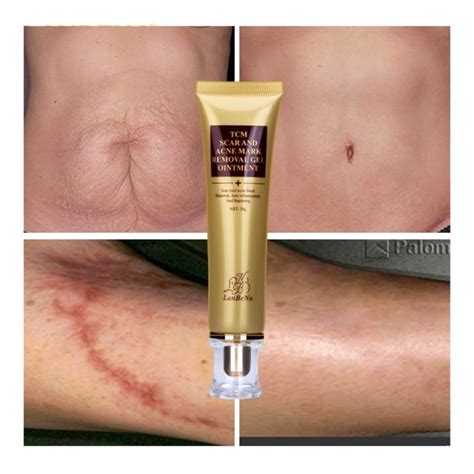 lanbena acne scar removal cream skin repair gearbeauty