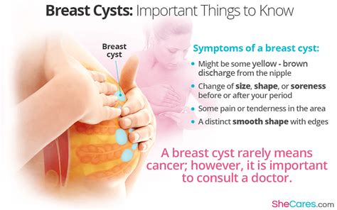 Is Breast Cancer More Common During Menopause Pin On 34 Menopause