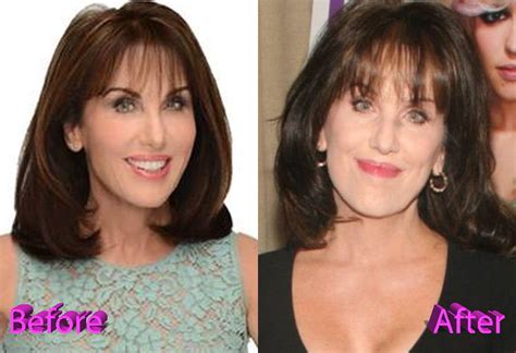 Reasons Why Robin Mcgraw Plastic Surgery Rumors Could Be True