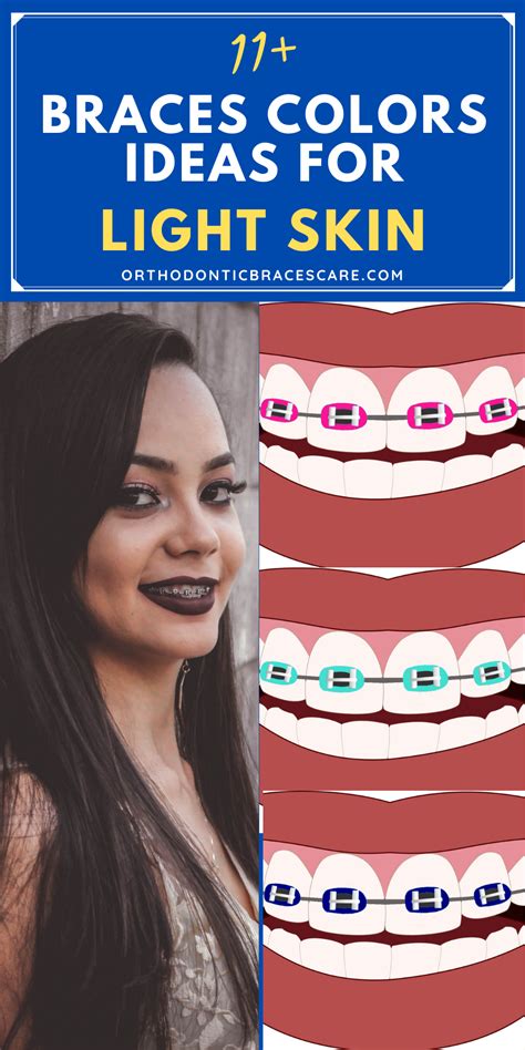 Best Braces Colors For Light Skin Makeovermania Amybaybeezz