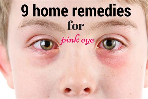 Home Remedy Pink Eye I Grandmas Home Remedies