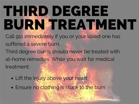 Burn Injury Burn Types Treatments And Causes