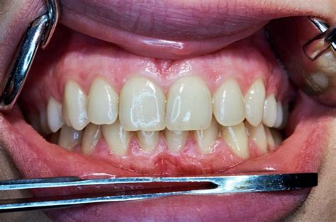 Healthy Adult Teeth Photograph By Dr Armen Taranyan