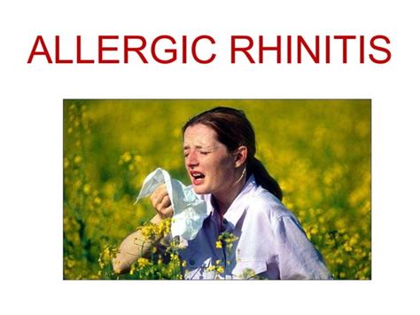 Allergic Rhinitis Ppt